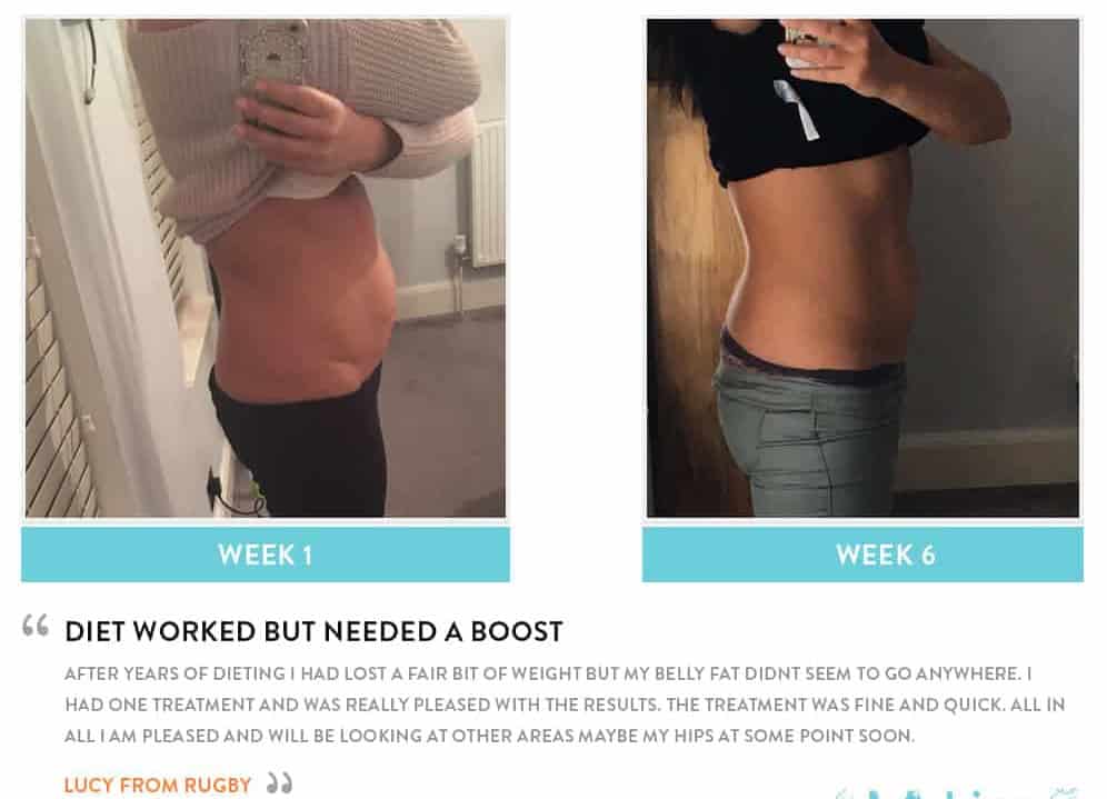 Before and After Dieting Lincoln