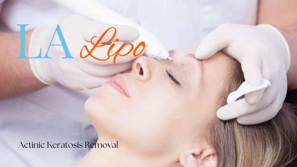 actinic keratosis removal Lincoln