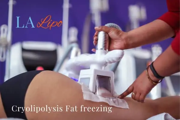 women getting fat freezing Lincoln