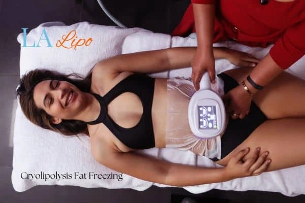 woman getting cryolipolysis Lincoln