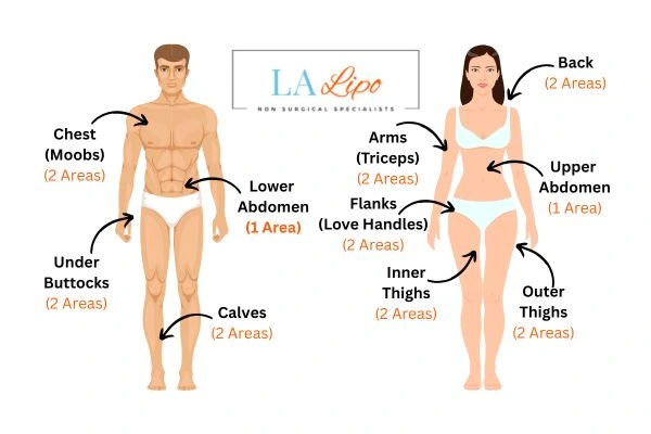 LA LIPO Cryolipolysis Areas Lincoln