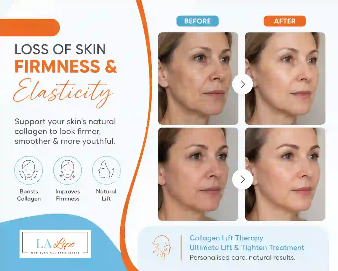 Sign #7: Loss of Skin Firmness and Elasticity Lincoln
